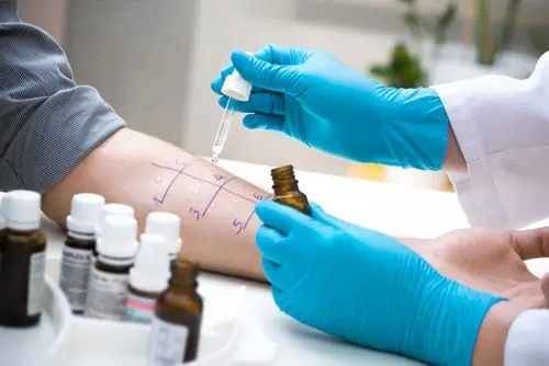 prix d'une consultation d'allergologie prix d'une consultation d'allergologie