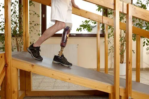 role du métier de l'orthoprothesiste rôle du métier de l'orthoprothésiste
