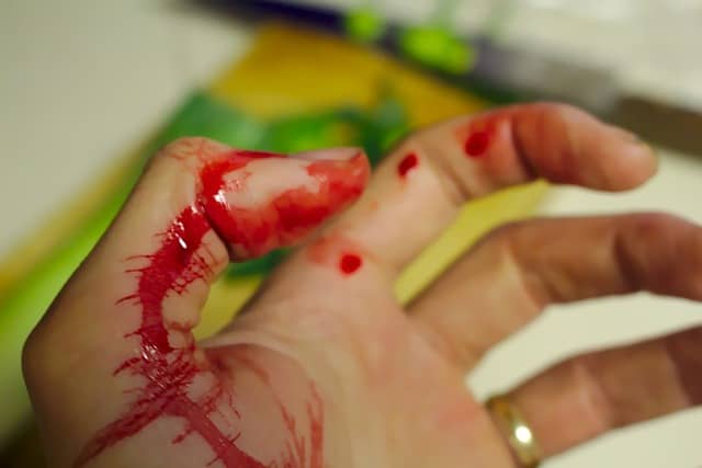 Exemple de plaie infectée à traiter Exemple de plaie infectée à traiter